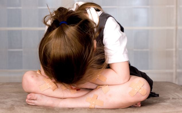 Concept of a young injured girl being a victim of child abuse